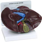   Human Liver & Gallbladder Anatomy Model with gallstones